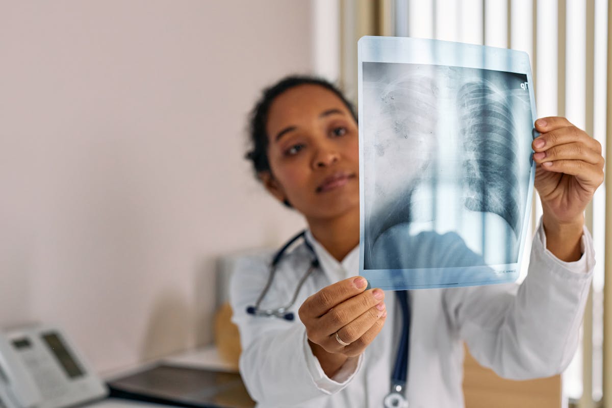 Respiratory disease assessment using lung imaging